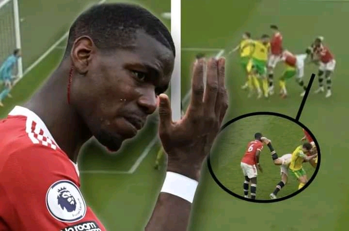  (Video) Paul Pogba left blooded and annoyed following head-kick from Harry Maguire.